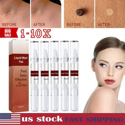 #ad 5PCS Wipe Off Skin Tags amp; Moles Removal Quick Safe Remover Restore Skin Hot $8.99