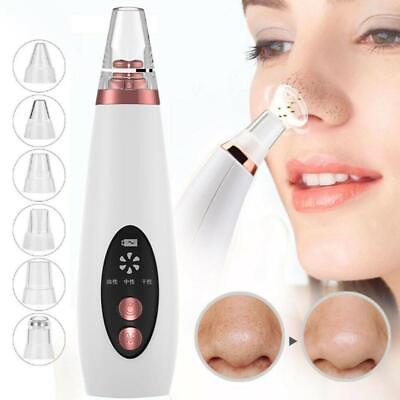 #ad Electric Cleaner Face Blackhead Remover Diamond Pore Vacuum Suction White Heads $7.00