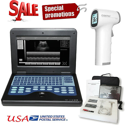 #ad Portable Laptop Machine B Ultrasound Scanner 3.5Mhz Convex Probe Abdomen US FDA $1249.00