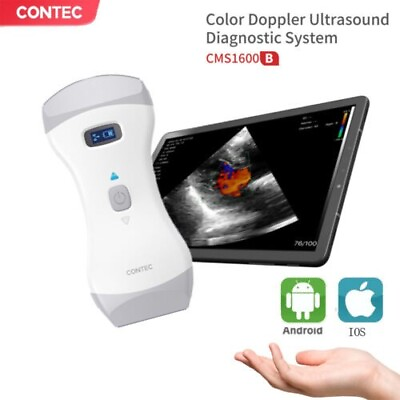 #ad #ad Portable Wireless Ultrasound Scanner Probe Wifi Color Doppler 3 year Warranty $2200.00