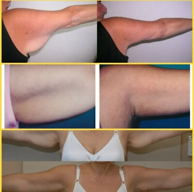 #ad flabby saggy arms no more cream firming slim tightening cellulite fat reducer $20.00
